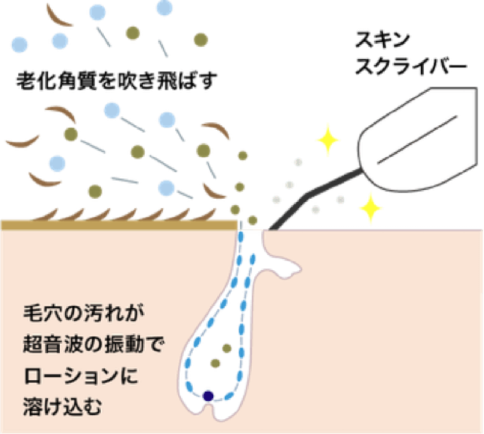 老化角質を吹き飛ばす スキンスクライバー 毛穴の汚れが超音波の振動でローションに溶け込む
