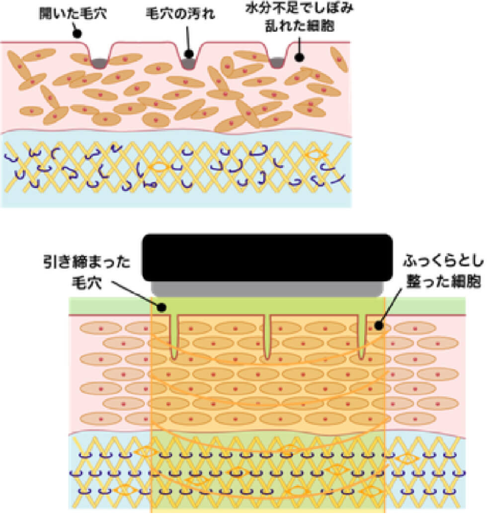 シミや小じわを目立たなくする